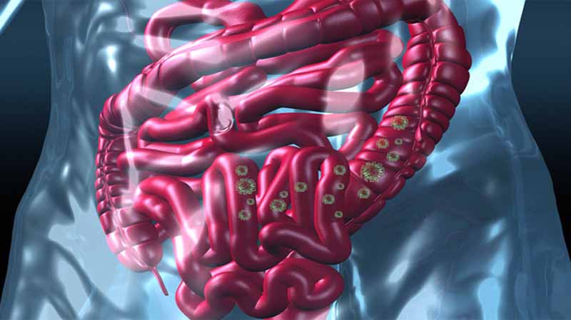 COVID-19 shows Gastrointestinal impact-Studies