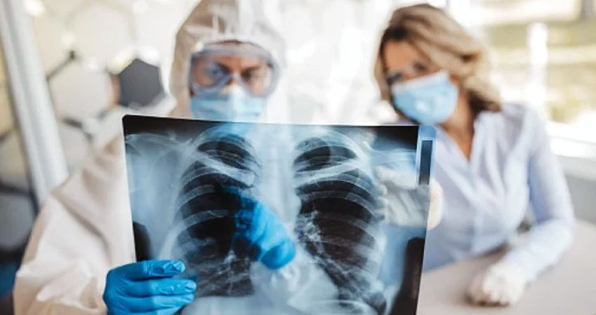 खोकीलाई सामान्य नठान्नुहोस्, लगातारकाे खोकीबाट हुनसक्छ फोक्सोको क्यान्सर