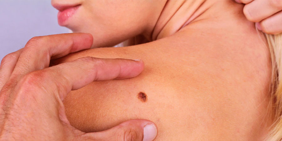 क्यान्सर भए/नभएको पत्ता लगाउन नियमित परीक्षण गर्नुपर्ने