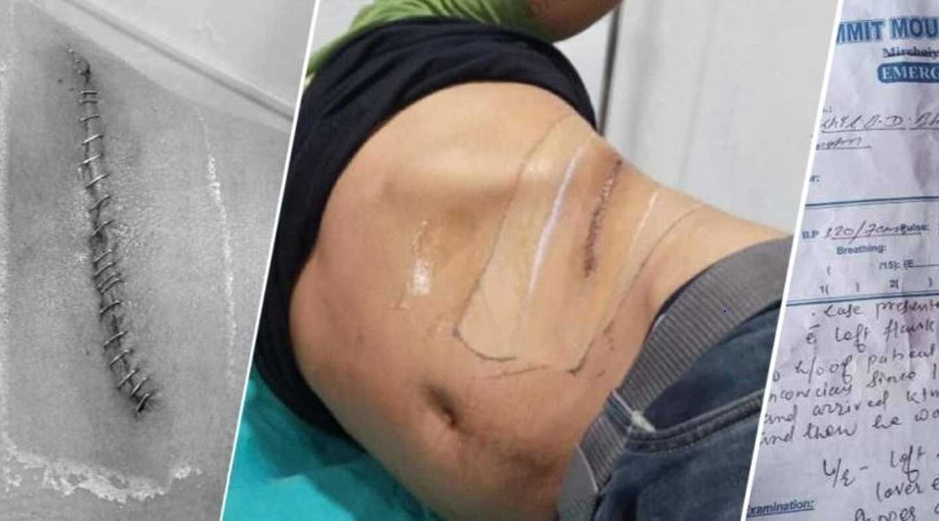 बन्धक बनाएर मिर्गौला निकाल्ने एक जना पक्राउ